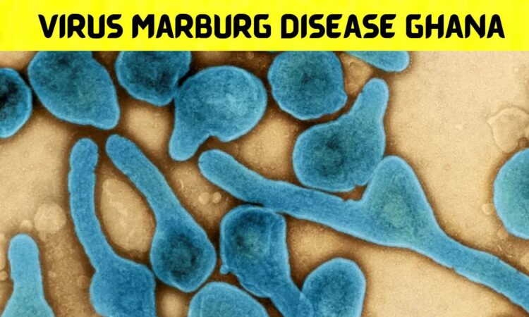 Virus Marburg Disease Ghana